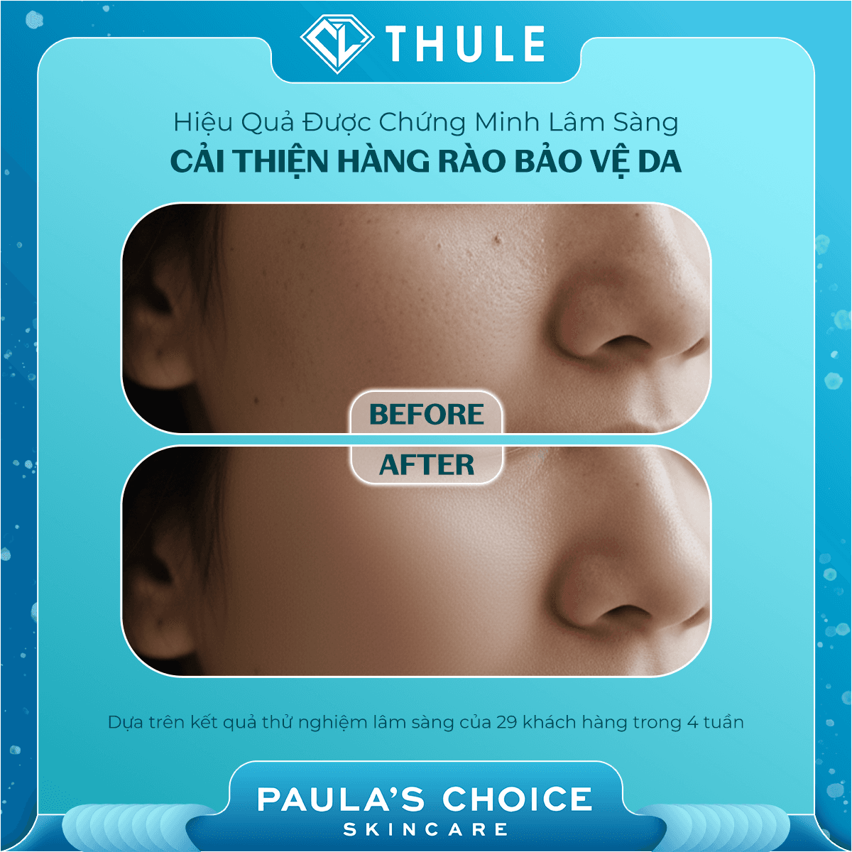 Dung Dịch Loại Bỏ Tế Bào Chết Skin Perfecting 2% BHA Liquid Exfoliant