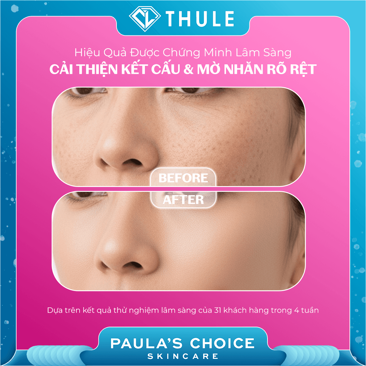 Tinh Chất Làm Căng Mịn Làm Giảm Nếp Nhăn, Săn Chắc Da - Pro-Collagen Multi-Peptide Booster