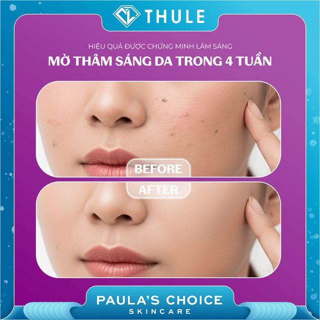 Tinh Chất Làm Mờ Thâm Nám, Làm Sáng Da - Clinical Discoloration Repair Serum 30ml