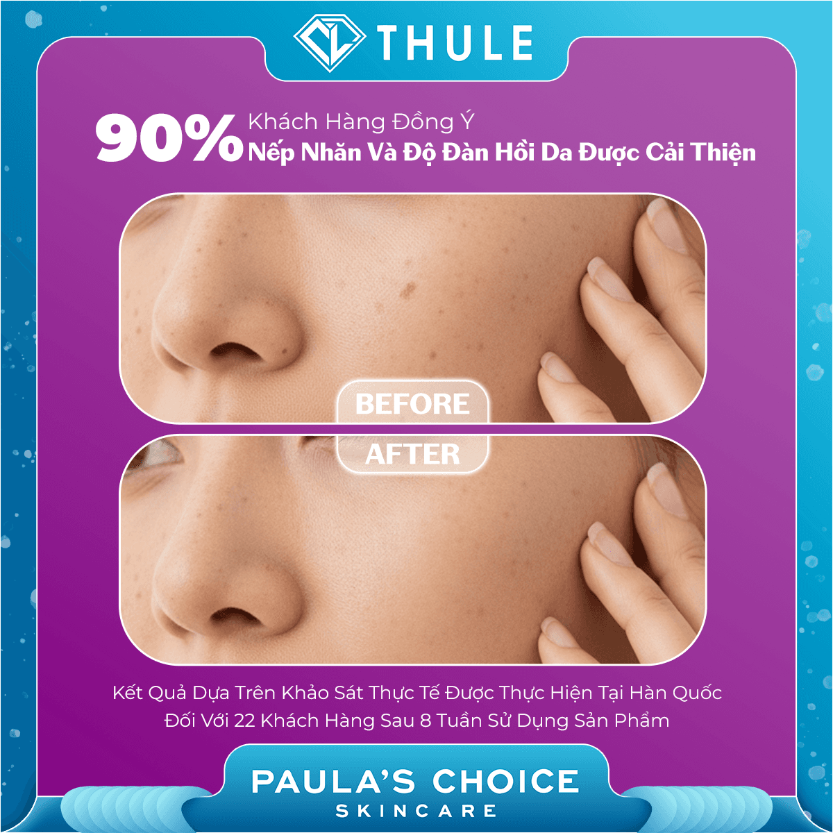 Tinh Chất Thu Nhỏ Lỗ Chân Lông To Và Làm Sáng Mịn Bề Mặt Da - Clinical Niacinamide 20% Treatment 20ml