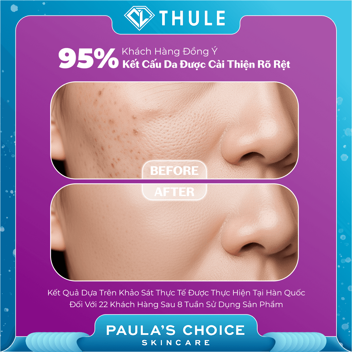 Tinh Chất Thu Nhỏ Lỗ Chân Lông To Và Làm Sáng Mịn Bề Mặt Da - Clinical Niacinamide 20% Treatment 20ml